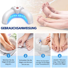 Lade das Bild in den Galerie-Viewer, PureNail - patentierte Nagelpilz-Therapie - für gesunde Nägel innerhalb von 4 Wochen
